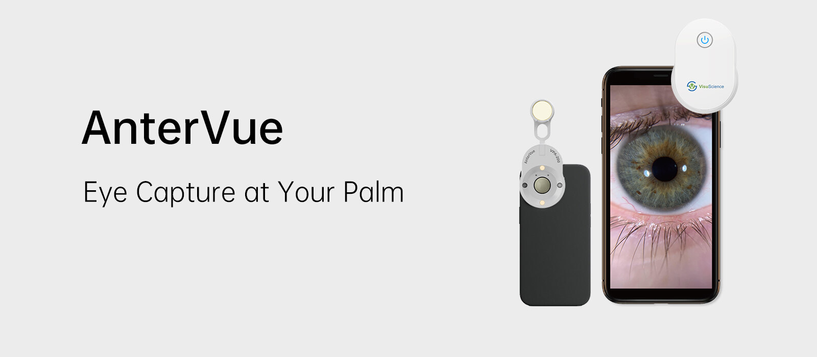 AnterVue — Eye Capture at Your Palm