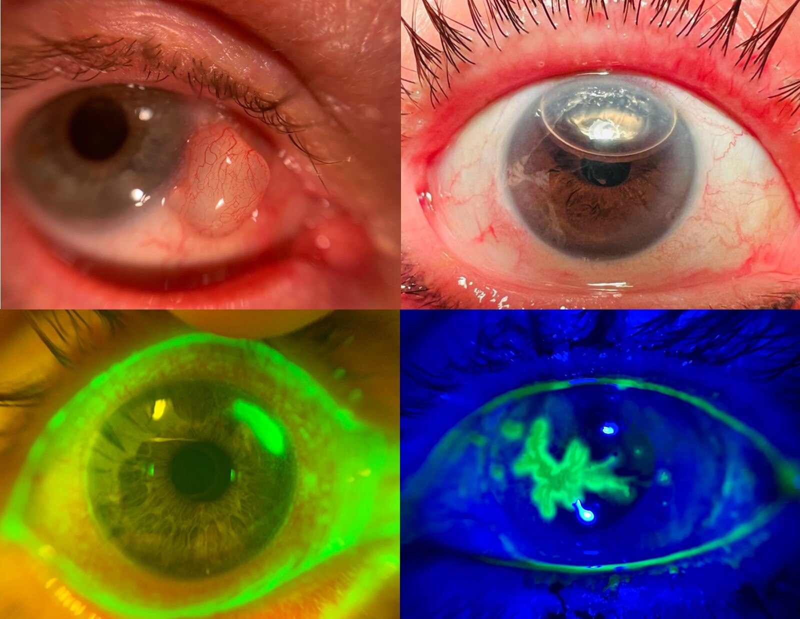 Efficient Corneal Disease Imaging & Documentation