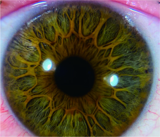 Flower Iris Pattern