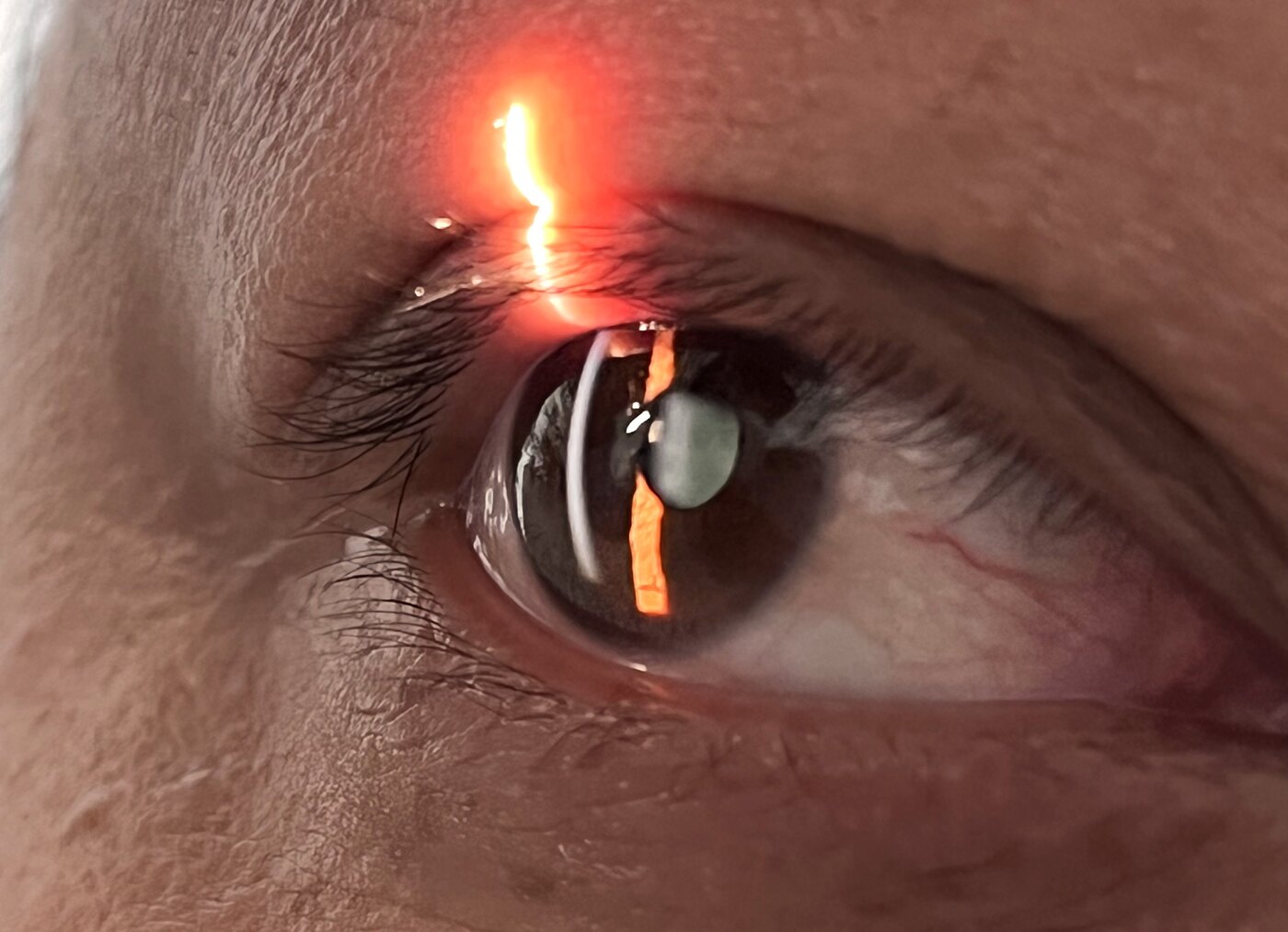 Portable slit lamp details